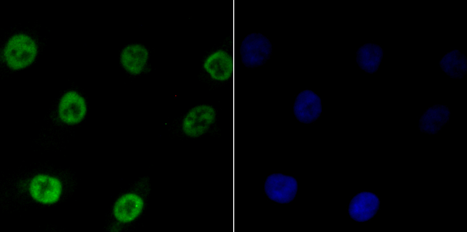 IF(ICC) staining with BUB3 (24D1) Monoclonal Antibody (bsm-54413R) 1:100 in A549 cells (green). The nuclear counterstain is DAPI (blue). Cells were fixed in paraformaldehyde, permeabilized with 0.25% Triton X100/PBS.