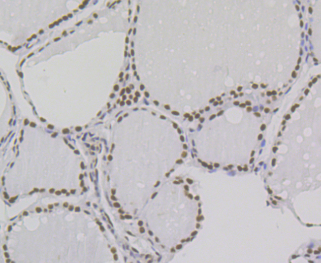 Paraformaldehyde-fixed and paraffin-embedded Human Thyroid Gland tissue incubated with BUB3 (24D1) Monoclonal Antibody (bsm-54413R) at 1:100, overnight at 4°C, followed by a conjugated secondary antibody and DAB staining. Counterstained with hematoxylin.