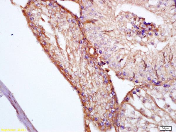 Formalin-fixed and paraffin embedded rat testis labeled with Anti-APOJ/Clusterin Polyclonal Antibody, Unconjugated (bs-1354R) at 1:200 followed by conjugation to the secondary antibody and DAB staining