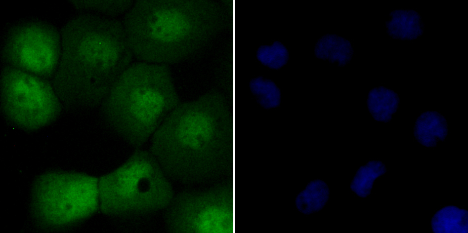 IF(ICC) staining with SUN1 (2C4) Monoclonal Antibody (bsm-54420R) 1:100 in A431 cells (green). The nuclear counterstain is DAPI (blue). Cells were fixed in paraformaldehyde, permeabilized with 0.25% Triton X100/PBS.