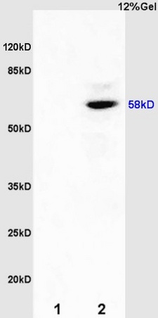 L1 mouse kidney lysates L2 mouse brain lysates probed with Anti ER-beta Polyclonal Antibody, Unconjugated (bs-0116R) at 1:200 overnight at 4˚C. Followed by conjugation to secondary antibody (bs-0295G-HRP) at 1:3000. Predicted band 58kD. Observed band size: 58kD