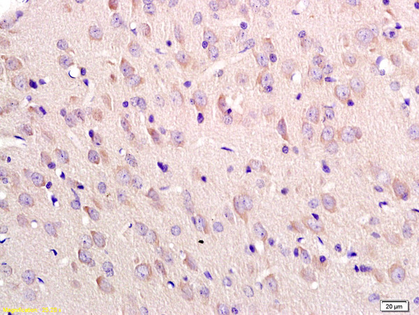 Formalin-fixed and paraffin embedded rat brain labeled with Anti-Tubulin-beta Polyclonal Antibody, Unconjugated (bs-0210R) at 1:200 followed by conjugation to the secondary antibody and DAB staining