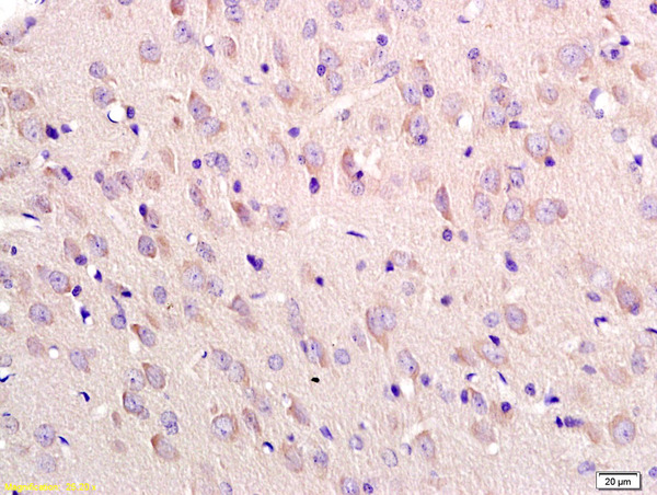 Formalin-fixed and paraffin embedded rat brain labeled with Anti-Tubulin-beta Polyclonal Antibody, Unconjugated (bs-0210R) at 1:200 followed by conjugation to the secondary antibody and DAB staining