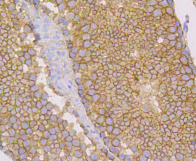 Paraformaldehyde-fixed and paraffin-embedded Mouse Testis tissue incubated with Nectin 2 (3G7) Monoclonal Antibody (bsm-54423R) at 1:100, overnight at 4°C, followed by a conjugated secondary antibody and DAB staining. Counterstained with hematoxylin.