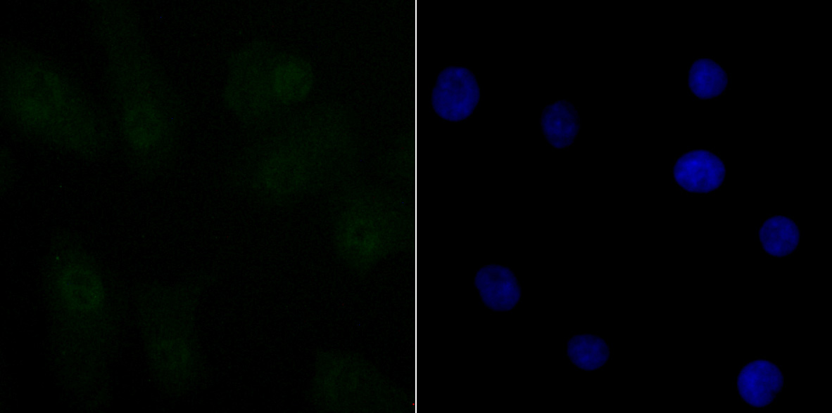 IF(ICC) staining with CTBP1 (3A12) Monoclonal Antibody (bsm-54424R) at 1:100 in A549 cells (green). The nuclear counterstain is DAPI (blue). Cells were fixed in paraformaldehyde, permeabilized with 0.25% Triton X100\/PBS.
