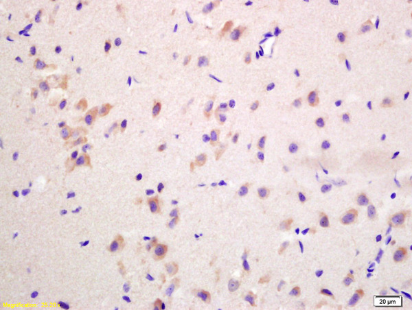 Formalin-fixed and paraffin embedded rat brain labeled with Anti-G protein beta subunit GI Polyclonal Antibody, Unconjugated (bs-0348R) at 1:200 followed by conjugation to the secondary antibody and DAB staining Formalin-fixed and paraffin embedded rat brain labeled with Anti-G protein beta subunit GI Polyclonal Antibody, Unconjugated (bs-0348R) at 1:200 followed by conjugation to the secondary antibody and DAB staining