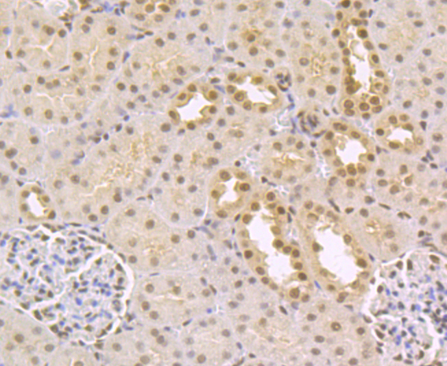 Paraformaldehyde-fixed and paraffin-embedded Rat Kidney tissue incubated with CTBP1 (3A12) Monoclonal Antibody (bsm-54424R) at 1:100, overnight at 4\u00b0C, followed by a conjugated secondary antibody and DAB staining. Counterstained with hematoxylin.
