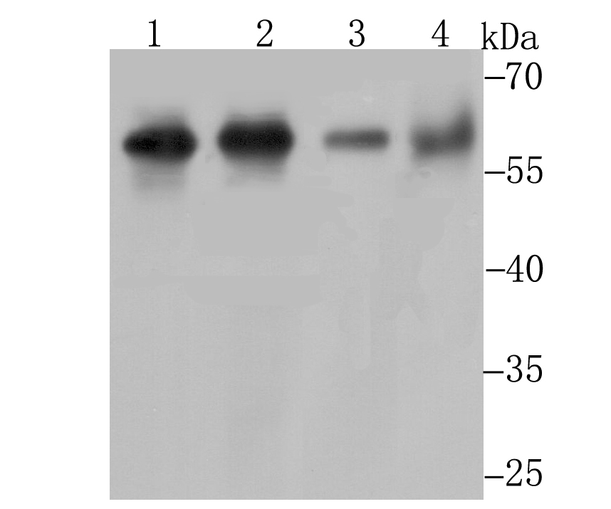 Lane 1: Daudi Cells; Lane 2: K562 Cells; Lane 3: Mouse Thymus; Lane 4: Mouse Kidney; Probed with Methionine Aminopeptidase 2 (2G3) Monoclonal Antibody (bsm-54425R) at 1:1000, overnight at 4°C followed by a conjugated secondary antibody for 60 minutes at 37°C. Lane 1: Daudi Cells; Lane 2: K562 Cells; Lane 3: Mouse Thymus; Lane 4: Mouse Kidney; Probed with Methionine Aminopeptidase 2 (2G3) Monoclonal Antibody (bsm-54425R) at 1:1000, overnight at 4°C followed by a conjugated secondary antibody for 60 minutes at 37°C.