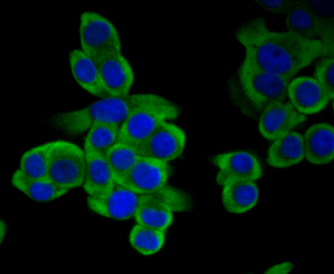 IF(ICC) staining with Methionine Aminopeptidase 2 (2G3) Monoclonal Antibody (bsm-54425R) at 1:100 in LOVO cells (green). The nuclear counterstain is DAPI (blue). Cells were fixed in paraformaldehyde, permeabilized with 0.25% Triton X100/PBS.