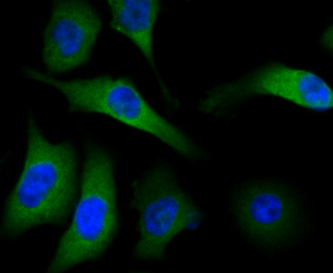 IF(ICC) staining with Methionine Aminopeptidase 2 (2G3) Monoclonal Antibody (bsm-54425R) at 1:100 in PC-3M cells (green). The nuclear counterstain is DAPI (blue). Cells were fixed in paraformaldehyde, permeabilized with 0.25% Triton X100/PBS.