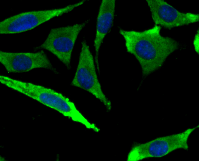 IF(ICC) staining with Methionine Aminopeptidase 2 (2G3) Monoclonal Antibody (bsm-54425R) at 1:100 in SH-SY5Y cells (green). The nuclear counterstain is DAPI (blue). Cells were fixed in paraformaldehyde, permeabilized with 0.25% Triton X100/PBS.