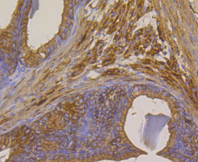 Paraformaldehyde-fixed and paraffin-embedded Mouse Seminal Vesicle tissue incubated with Methionine Aminopeptidase 2 (2G3) Monoclonal Antibody (bsm-54425R) at 1:100, overnight at 4°C, followed by a conjugated secondary antibody and DAB staining. Counterstained with hematoxylin.