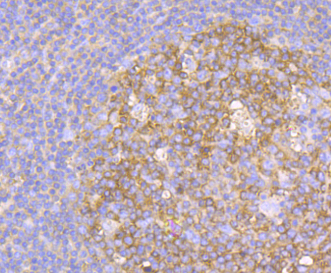 Paraformaldehyde-fixed and paraffin-embedded Human Tonsil tissue incubated with Methionine Aminopeptidase 2 (2G3) Monoclonal Antibody (bsm-54425R) at 1:100, overnight at 4°C, followed by a conjugated secondary antibody and DAB staining. Counterstained with hematoxylin.