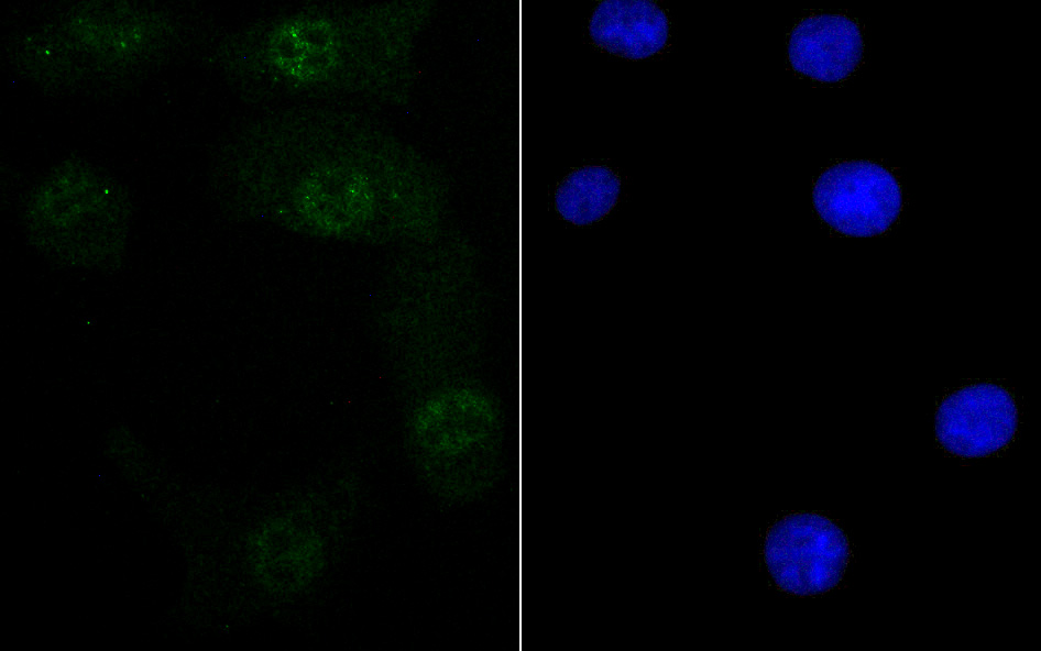 IF(ICC) staining with Retinoid X Receptor alpha (3B5) Monoclonal Antibody (bsm-54427R) at 1:100 in A549 cells (green). The nuclear counterstain is DAPI (blue). Cells were fixed in paraformaldehyde, permeabilized with 0.25% Triton X100/PBS.