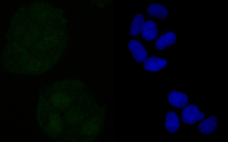 IF(ICC) staining with Retinoid X Receptor alpha (3B5) Monoclonal Antibody (bsm-54427R) at 1:100 in Hela cells (green). The nuclear counterstain is DAPI (blue). Cells were fixed in paraformaldehyde, permeabilized with 0.25% Triton X100/PBS.