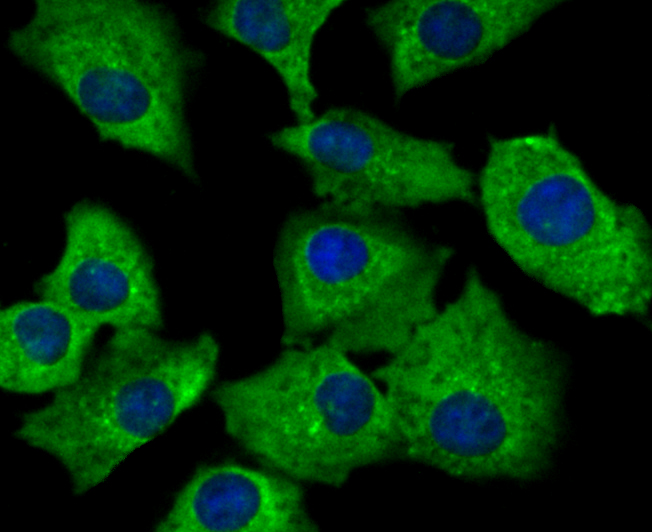 IF(ICC) staining with SNX1 (4C2) Monoclonal Antibody (bsm-54429R) at 1:100 in A549 cells (green). The nuclear counterstain is DAPI (blue). Cells were fixed in paraformaldehyde, permeabilized with 0.25% Triton X100/PBS.