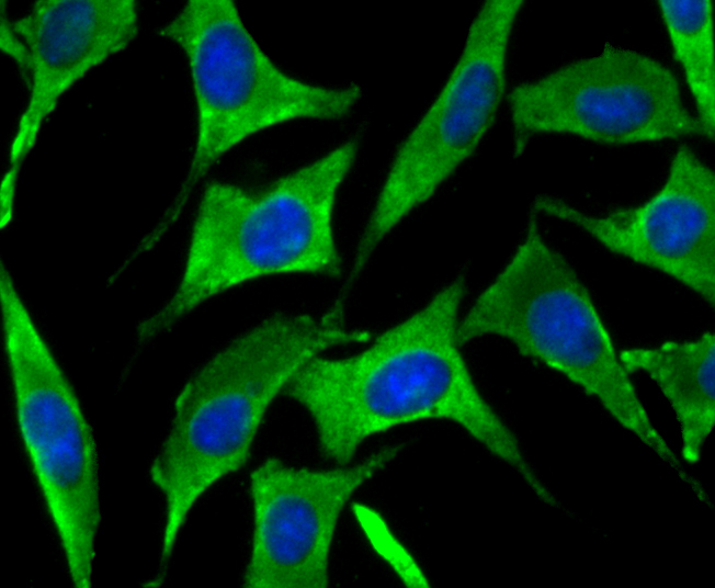 IF(ICC) staining with SNX1 (4C2) Monoclonal Antibody (bsm-54429R) at 1:100 in SH-SY5Y cells (green). The nuclear counterstain is DAPI (blue). Cells were fixed in paraformaldehyde, permeabilized with 0.25% Triton X100/PBS.