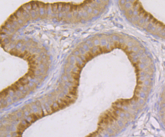 Paraformaldehyde-fixed and paraffin-embedded Rat Epididymis tissue incubated with SNX1 (4C2) Monoclonal Antibody (bsm-54429R) at 1:100, overnight at 4°C, followed by a conjugated secondary antibody and DAB staining. Counterstained with hematoxylin.