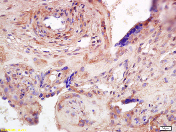 Formalin-fixed and paraffin embedded human placenta labeled with Anti-ADAMTS7 Polyclonal Antibody, Unconjugated (bs-0433R) at 1:200 followed by conjugation to the secondary antibody and DAB staining