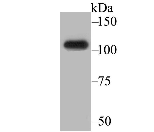 Lane 1: SiHa Cells; Probed with BRD2 (6B5) Monoclonal Antibody (bsm-54434R) at 1:2000, overnight at 4°C followed by a conjugated secondary antibody for 60 minutes at 37°C.
