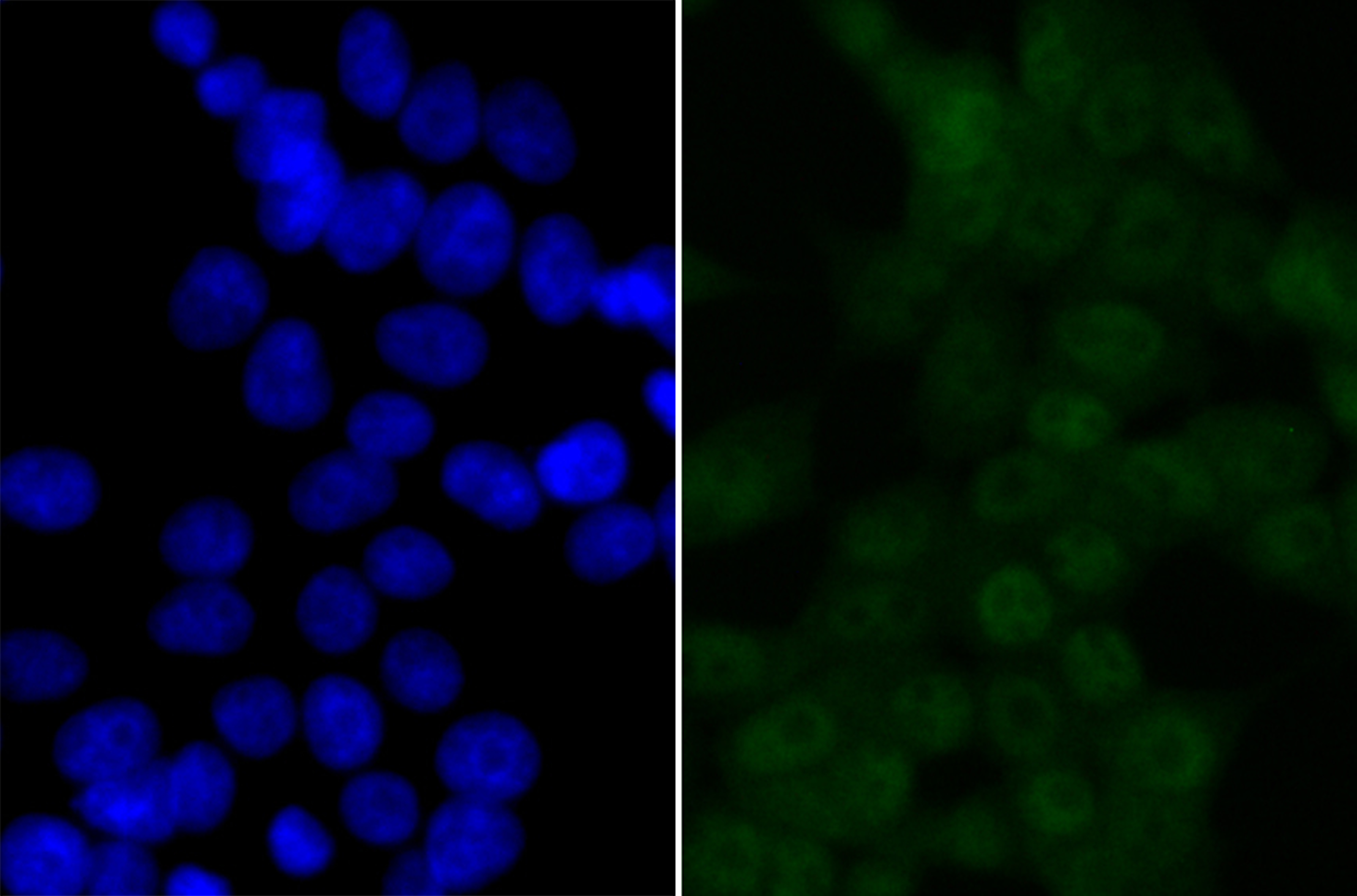 IF(ICC) staining with BRD2 (6B5) Monoclonal Antibody (bsm-54434R) at 1:100 in 293T cells (green). The nuclear counterstain is DAPI (blue). Cells were fixed in paraformaldehyde, permeabilized with 0.25% Triton X100/PBS.