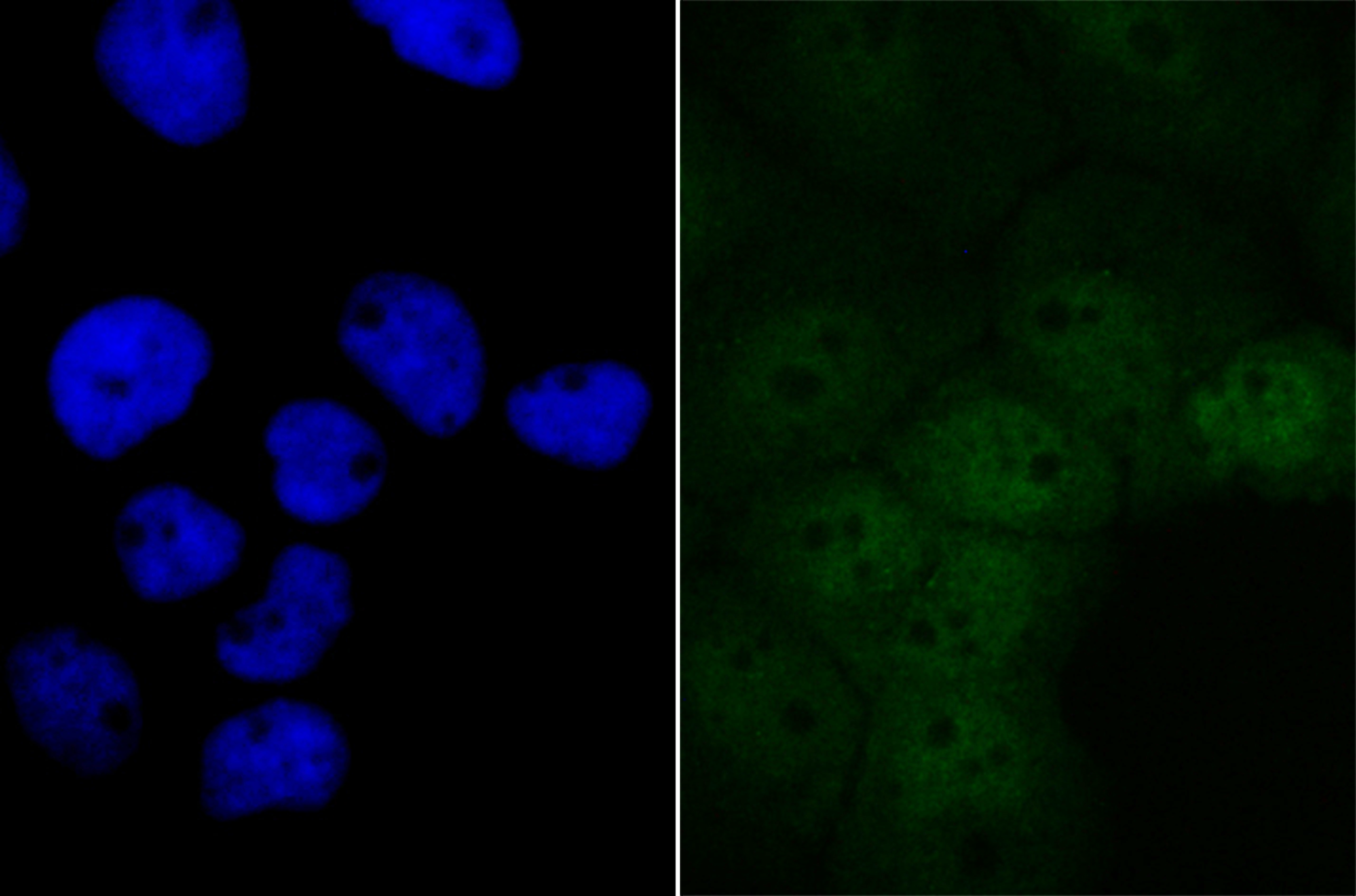 IF(ICC) staining with BRD2 (6B5) Monoclonal Antibody (bsm-54434R) at 1:100 in A431 cells (green). The nuclear counterstain is DAPI (blue). Cells were fixed in paraformaldehyde, permeabilized with 0.25% Triton X100/PBS.