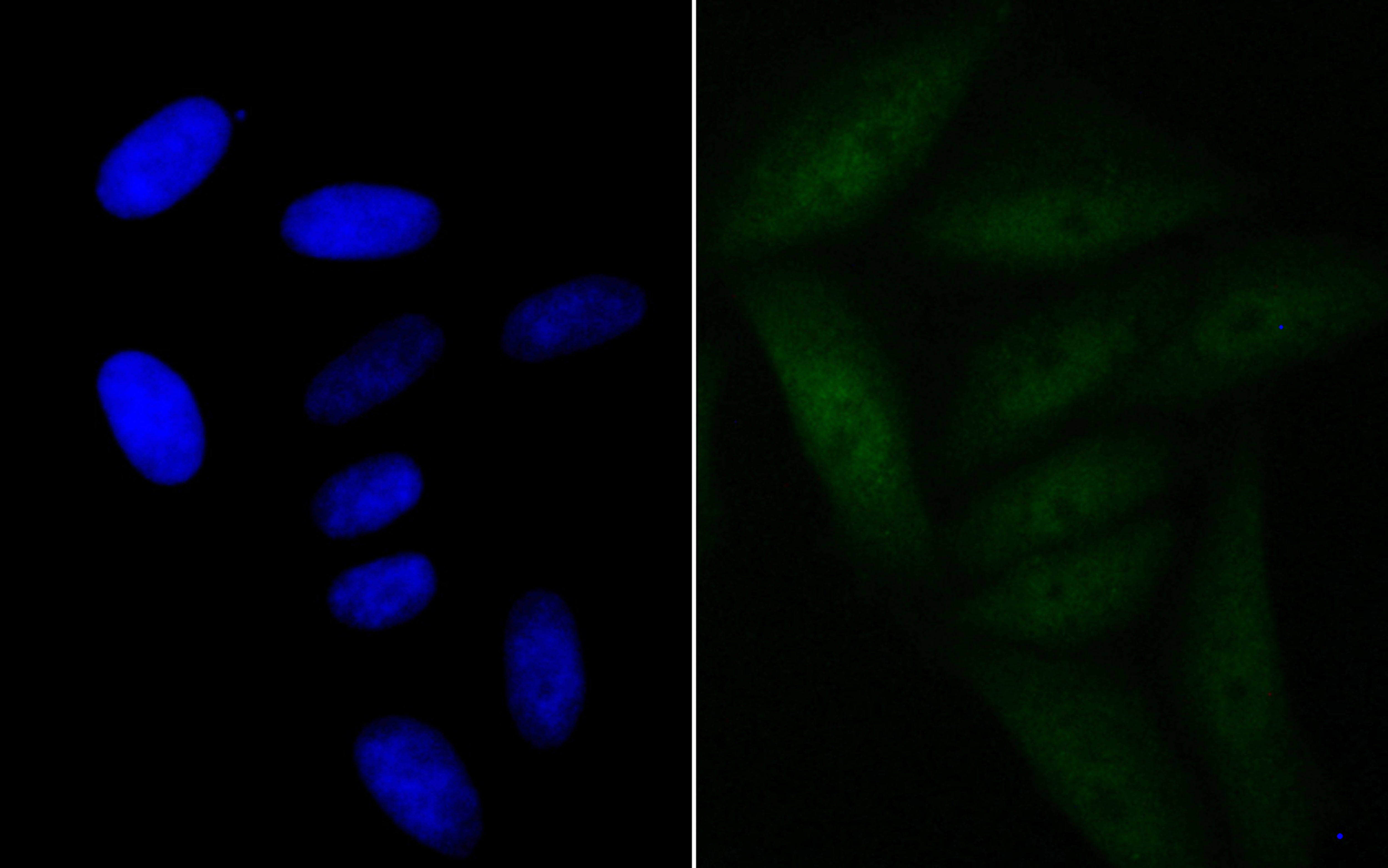 IF(ICC) staining with BRD2 (6B5) Monoclonal Antibody (bsm-54434R) at 1:100 in SiHa cells (green). The nuclear counterstain is DAPI (blue). Cells were fixed in paraformaldehyde, permeabilized with 0.25% Triton X100/PBS.