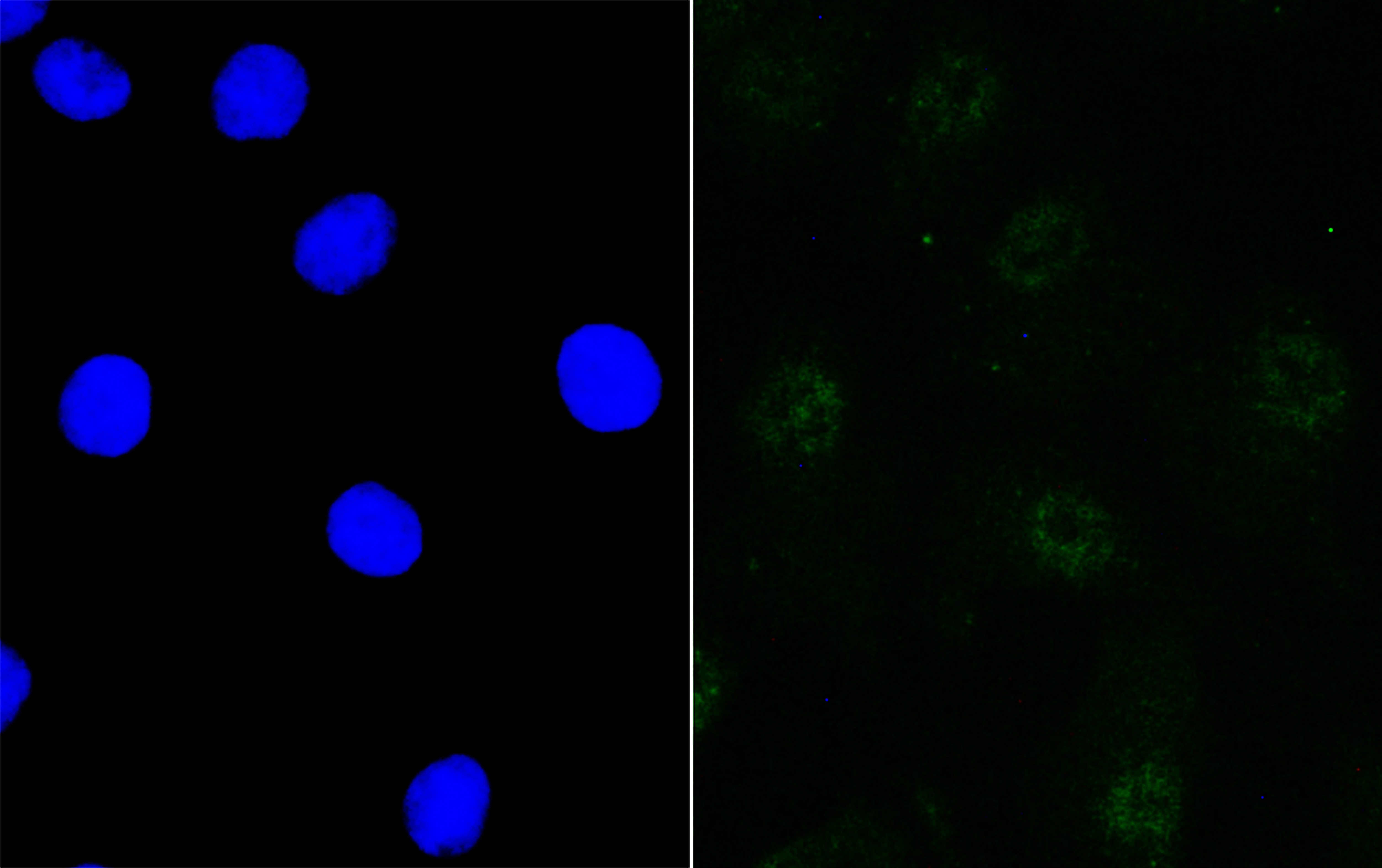 IF(ICC) staining with BANF1 (11H3) Monoclonal Antibody (bsm-54435R) at 1:100 in A549 cells (green). The nuclear counterstain is DAPI (blue). Cells were fixed in paraformaldehyde, permeabilized with 0.25% Triton X100/PBS.