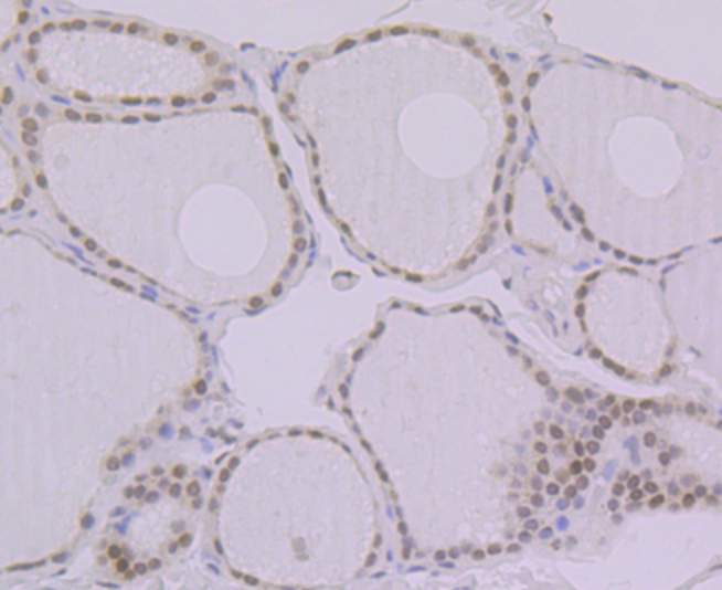 Paraformaldehyde-fixed and paraffin-embedded Human Thyroid tissue incubated with BANF1 (11H3) Monoclonal Antibody (bsm-54435R) at 1:100, overnight at 4°C, followed by a conjugated secondary antibody and DAB staining. Counterstained with hematoxylin. Paraformaldehyde-fixed and paraffin-embedded Human Thyroid tissue incubated with BANF1 (11H3) Monoclonal Antibody (bsm-54435R) at 1:100, overnight at 4°C, followed by a conjugated secondary antibody and DAB staining. Counterstained with hematoxylin.