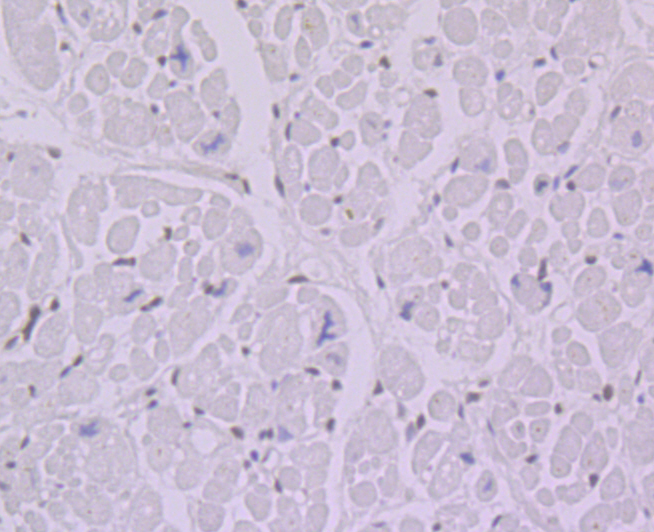 Paraformaldehyde-fixed and paraffin-embedded Human Heart tissue incubated with BANF1 (11H3) Monoclonal Antibody (bsm-54435R) at 1:100, overnight at 4°C, followed by a conjugated secondary antibody and DAB staining. Counterstained with hematoxylin. Paraformaldehyde-fixed and paraffin-embedded Human Heart tissue incubated with BANF1 (11H3) Monoclonal Antibody (bsm-54435R) at 1:100, overnight at 4°C, followed by a conjugated secondary antibody and DAB staining. Counterstained with hematoxylin.