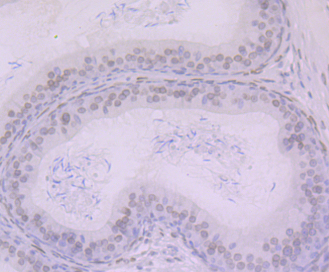 Paraformaldehyde-fixed and paraffin-embedded Rat Epididymis tissue incubated with BANF1 (11H3) Monoclonal Antibody (bsm-54435R) at 1:100, overnight at 4°C, followed by a conjugated secondary antibody and DAB staining. Counterstained with hematoxylin. Paraformaldehyde-fixed and paraffin-embedded Rat Epididymis tissue incubated with BANF1 (11H3) Monoclonal Antibody (bsm-54435R) at 1:100, overnight at 4°C, followed by a conjugated secondary antibody and DAB staining. Counterstained with hematoxylin.