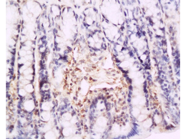 Formalin-fixed and paraffin embedded rat colon tissue labeled with Anti-P-selectin Polyclonal Antibody (bs-0561R), Unconjugated at 1:200, followed by conjugation to the secondary antibody and DAB staining