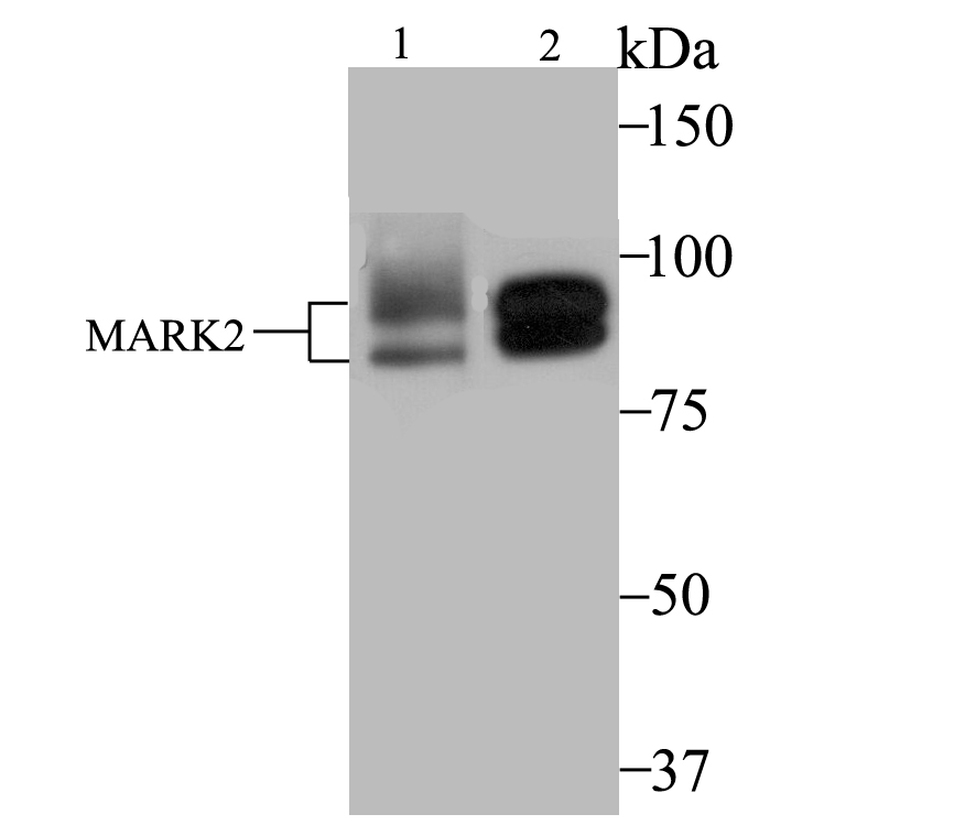Lane 1: MCF-7 Cells; Lane 2: SK-Br-3 Cells; Probed with MARK2 (1F10) Monoclonal Antibody (bsm-54447R) at 1:2000, overnight at 4°C followed by a conjugated secondary antibody for 60 minutes at 37°C.