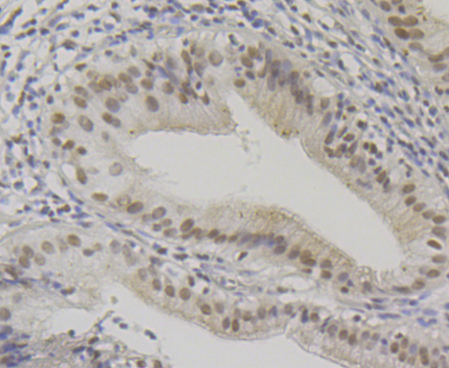 Paraformaldehyde-fixed and paraffin-embedded Human Gallbladder tissue incubated with SMARCE1 (4D2) Monoclonal Antibody (bsm-54449R) at 1:100, overnight at 4°C, followed by a conjugated secondary antibody and DAB staining. Counterstained with hematoxylin.