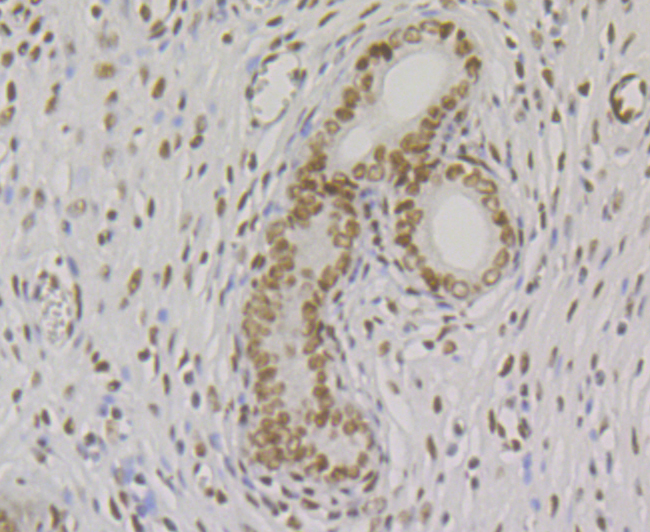 Paraformaldehyde-fixed and paraffin-embedded Rat Uterus tissue incubated with SMARCE1 (4D2) Monoclonal Antibody (bsm-54449R) at 1:100, overnight at 4°C, followed by a conjugated secondary antibody and DAB staining. Counterstained with hematoxylin.