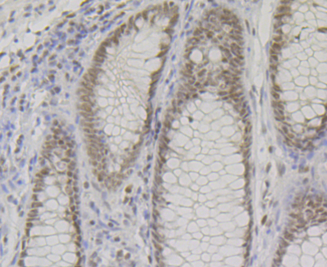 Paraformaldehyde-fixed and paraffin-embedded Human Colon tissue incubated with SMARCE1 (4D2) Monoclonal Antibody (bsm-54449R) at 1:100, overnight at 4°C, followed by a conjugated secondary antibody and DAB staining. Counterstained with hematoxylin.