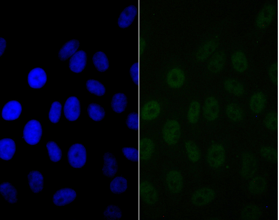 IF(ICC) staining with SMARCE1 (4D2) Monoclonal Antibody (bsm-54449R) at 1:100 in HepG2 cells (green). The nuclear counterstain is DAPI (blue). Cells were fixed in paraformaldehyde, permeabilized with 0.25% Triton X100/PBS.