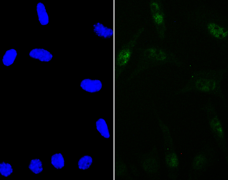 IF(ICC) staining with SMARCE1 (4D2) Monoclonal Antibody (bsm-54449R) at 1:100 in SH-SY5Y cells (green). The nuclear counterstain is DAPI (blue). Cells were fixed in paraformaldehyde, permeabilized with 0.25% Triton X100/PBS.