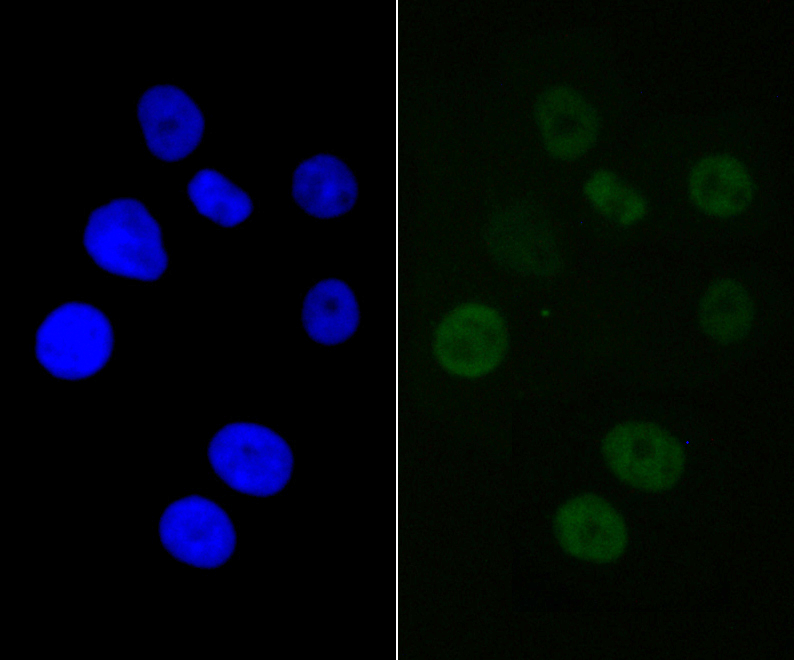 IF(ICC) staining with SMARCE1 (4D2) Monoclonal Antibody (bsm-54449R) at 1:100 in SK-Br-3 cells (green). The nuclear counterstain is DAPI (blue). Cells were fixed in paraformaldehyde, permeabilized with 0.25% Triton X100/PBS.