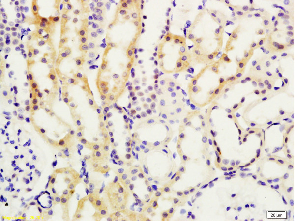 Formalin-fixed and paraffin embedded rat kidney tissue labeled with Anti-Smad7/Smad6 Polyclonal Antibody (bs-0566R), Unconjugated at 1:200, followed by conjugation to the secondary antibody and DAB staining