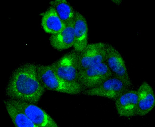 IF(ICC) staining with TRK fused gene (5C1) Monoclonal Antibody (bsm-52676R) at 1:100 in HeLa cells (green). The nuclear counterstain is DAPI (blue). Cells were fixed in paraformaldehyde, permeabilized with 0.25% Triton X100/PBS.