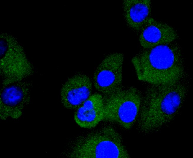 IF(ICC) staining with TRK fused gene (5C1) Monoclonal Antibody (bsm-52676R) at 1:100 in A549 cells (green). The nuclear counterstain is DAPI (blue). Cells were fixed in paraformaldehyde, permeabilized with 0.25% Triton X100/PBS.