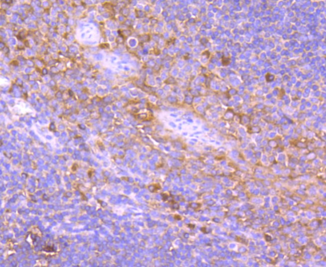 Paraformaldehyde-fixed and paraffin-embedded Human tonsil tissue incubated with TRK fused gene (5C1) Monoclonal Antibody (bsm-52676R) at 1:100, overnight at 4°C, followed by a conjugated secondary antibody and DAB staining. Counterstained with hematoxylin.
