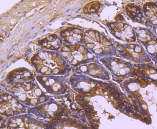 Paraformaldehyde-fixed and paraffin-embedded Mouse colon tissue incubated with TRK fused gene (5C1) Monoclonal Antibody (bsm-52676R) at 1:100, overnight at 4°C, followed by a conjugated secondary antibody and DAB staining. Counterstained with hematoxylin.