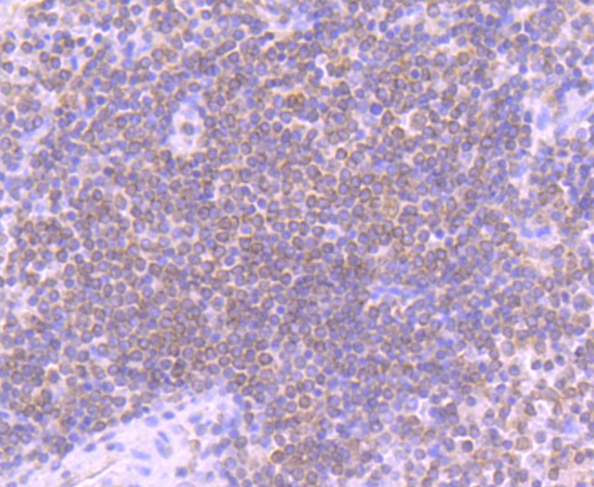 Paraformaldehyde-fixed and paraffin-embedded Human spleen tissue incubated with Stromal interaction molecule 1 (7C4) Monoclonal Antibody (bsm-52677R) at 1:100, overnight at 4°C, followed by a conjugated secondary antibody and DAB staining. Counterstained with hematoxylin.
