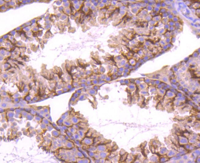 Paraformaldehyde-fixed and paraffin-embedded Mouse testis tissue incubated with Stromal interaction molecule 1 (7C4) Monoclonal Antibody (bsm-52677R) at 1:100, overnight at 4°C, followed by a conjugated secondary antibody and DAB staining. Counterstained with hematoxylin.