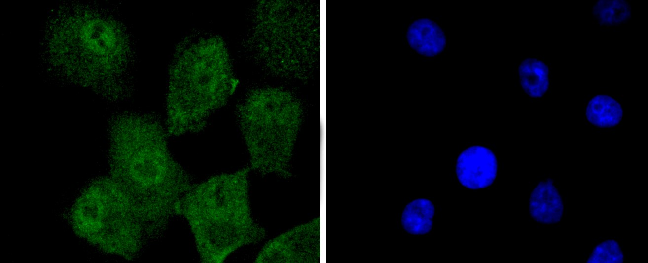 IF(ICC) staining with KAP1 (7C5) Monoclonal Antibody (bsm-52679R) at 1:100 in A549 cells (green). The nuclear counterstain is DAPI (blue). Cells were fixed in paraformaldehyde, permeabilized with 0.25% Triton X100/PBS.
