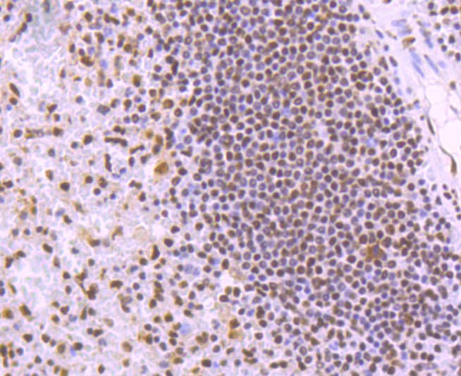 Paraformaldehyde-fixed and paraffin-embedded Human spleen tissue incubated with KAP1 (7C5) Monoclonal Antibody (bsm-52679R) at 1:100, overnight at 4°C, followed by a conjugated secondary antibody and DAB staining. Counterstained with hematoxylin.