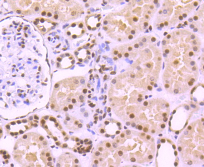 Paraformaldehyde-fixed and paraffin-embedded Human kidney tissue incubated with KAP1 (7C5) Monoclonal Antibody (bsm-52679R) at 1:100, overnight at 4°C, followed by a conjugated secondary antibody and DAB staining. Counterstained with hematoxylin.