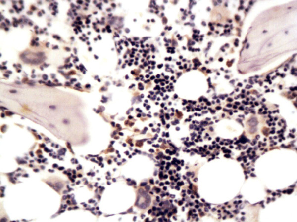 Formalin-fixed and paraffin embedded rat articular cartilage labeled with Anti-MMP-13 Polyclonal Antibody (bs-0575R), Unconjugated at 1:200, followed by conjugation to the secondary antibody and DAB staining
